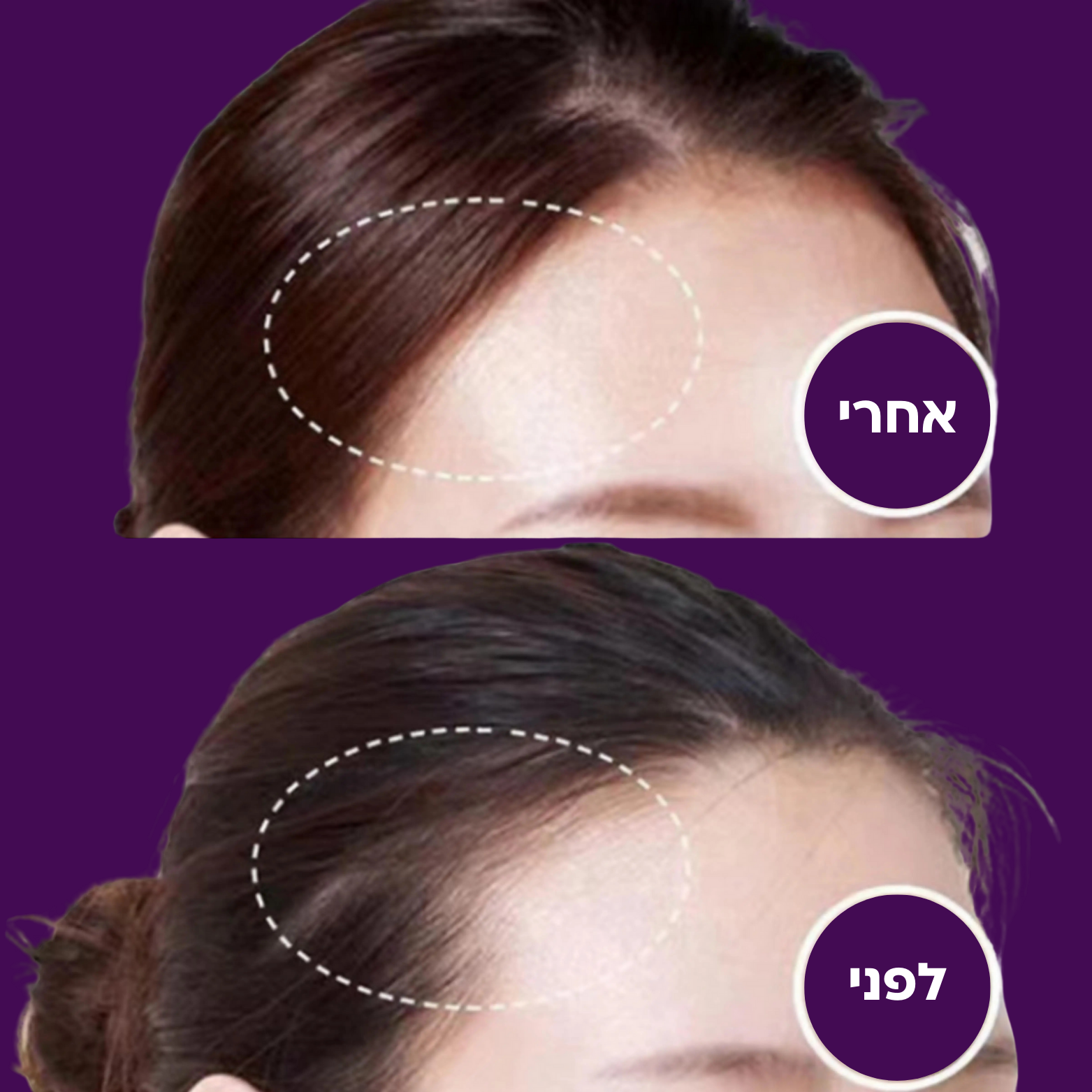כיסוי שורשים עמיד